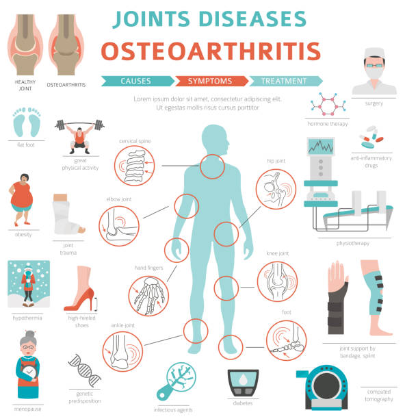 illustrations, cliparts, dessins animés et icônes de maladies articulaires. arthrite, symptômes d’arthrose, ensemble d’icônes de traitement. conception infographie médicale - human skeleton people human spine human bone