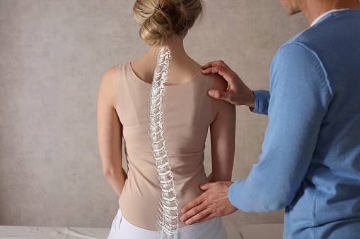 Escoliosis Escoliosis Curva de la columna Anatomía, Corrección de la postura. Tratamiento quiropráctico, alivio del dolor de espalda. photo