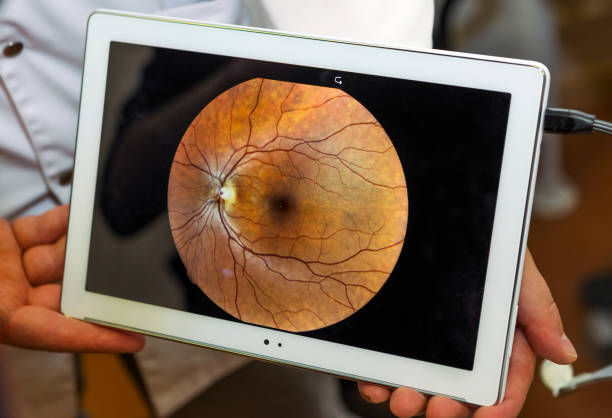 Woman UNERGO eyes test. Ocular fundus. Visit to the doctor. Woman UNERGO eyes test. Ocular fundus. Visit to the doctor. glaucoma photos stock pictures, royalty-free photos & images
