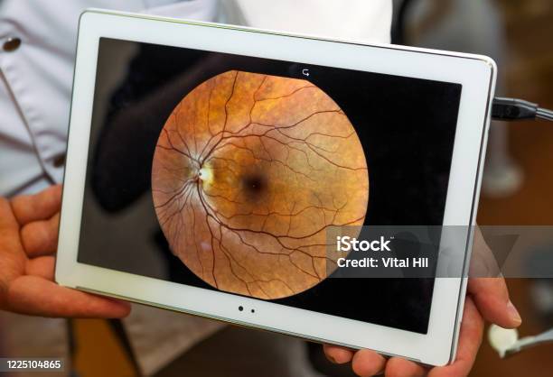 Woman Unergo Eyes Test Ocular Fundus Visit To The Doctor Stock Photo - Download Image Now