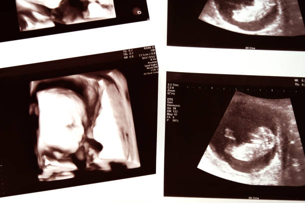 2D and 4D picture of ultrasound baby. 2D and 4D picture of ultrasound baby. 3d scanning photos stock pictures, royalty-free photos & images
