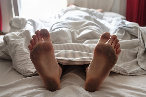 Dirty bare feet of a sleeping person showing out of the blanket on a bed. Hygiene or unsanitary conditions concept
