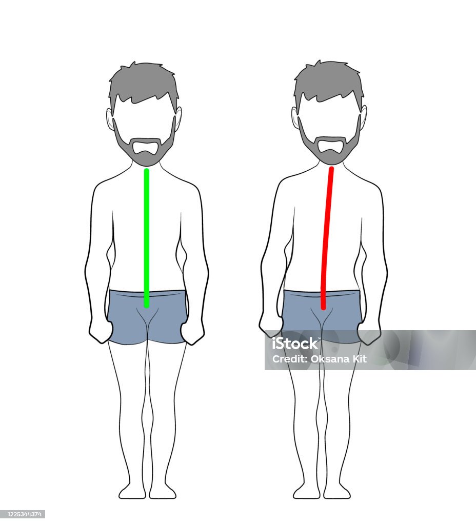 Correct Alignment Of Human Body In Standing Posture For Good ... Biology Diagrams