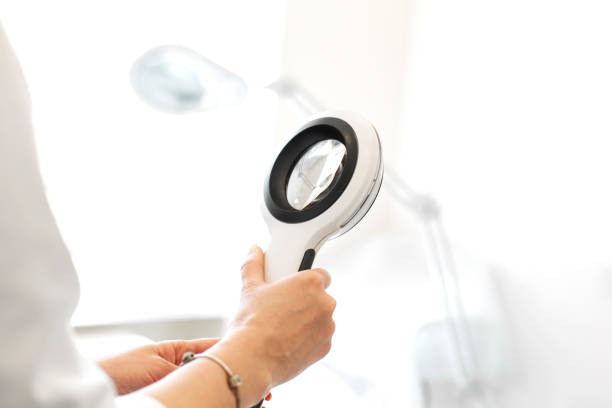 Doctor trichologist dermatologist holding a magnifying glass for examination of a patient Doctor trichologist dermatologist holding a magnifying glass for examination of a patient. skin exame stock pictures, royalty-free photos & images