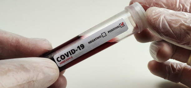 istock Coronavirus (COVID-19) medical test 1225482295