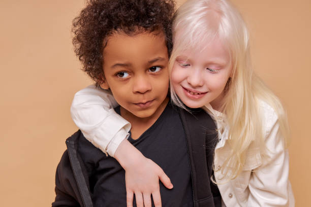 istock diverse black and albino kids in love 1225497606