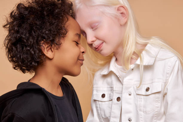 istock diverse black and albino kids in love 1225497629