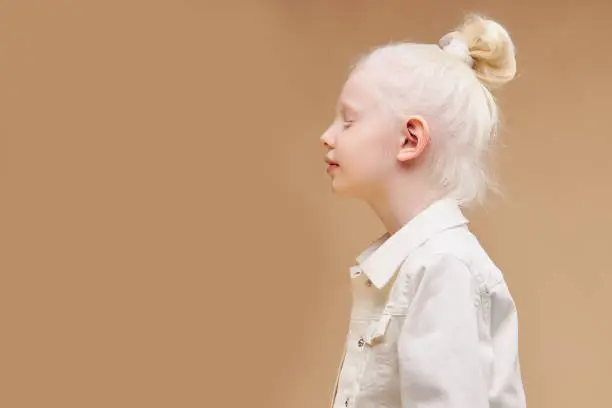 Photo of strange little girl with unusual appearance, alien concept. albino