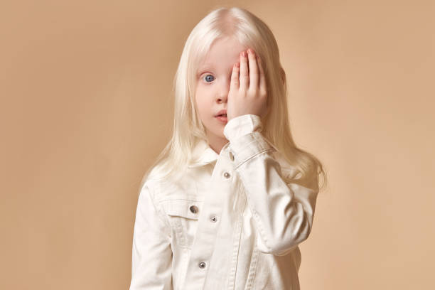 6,581 Albino People Stock Photos, Pictures & Royalty-Free Images - iStock | Albino woman, Albino girl, Indian 6,581 Albino People Stock Photos, Pictures & Royalty-Free Images - iStock | Albino woman, Albino girl, Indian