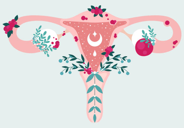 婦女健康。花中子宮內膜異位症的解剖方案。子宮內膜疾病-生殖系統圖 - 性與生殖 插圖 幅插畫檔、美工圖案、卡通及圖標