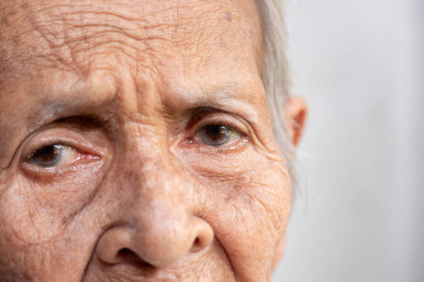 istock The old woman's felling lonely.(dementia and Alzheimer’s disease) 1225526540