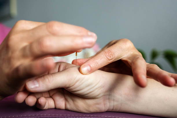 agopuntura agopuntura in mano - massaging relaxation indoors traditional culture foto e immagini stock