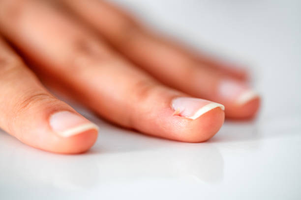 istock Nail biter stock photo 1225680106