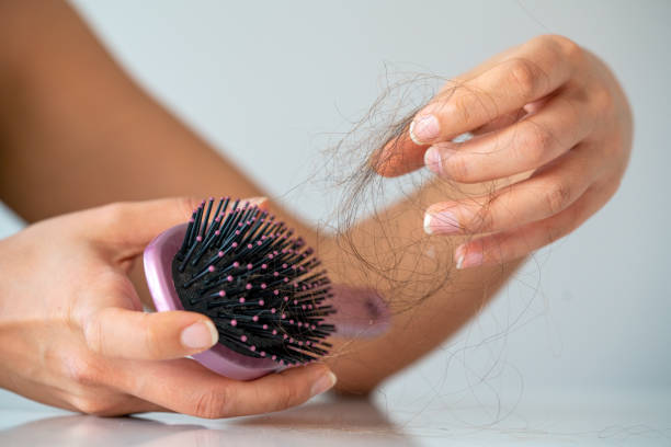 Woman losing hair on hairbrush in hand on bathroom background stock photo Losing hair? Hair brush, complete with hair. hair loss stock pictures, royalty-free photos & images