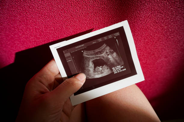 istock ultrasound scan during pregnancy 1225732289