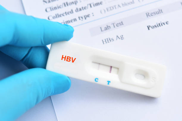 istock Hepatitis B virus positive test result 1225820328