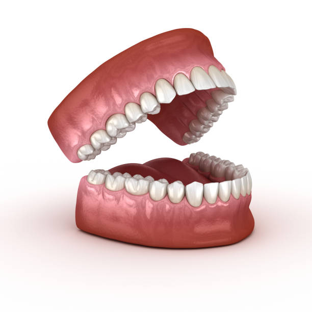 dental anatomy - opened dentures. medically accurate dental 3d illustration - morphology imagens e fotografias de stock