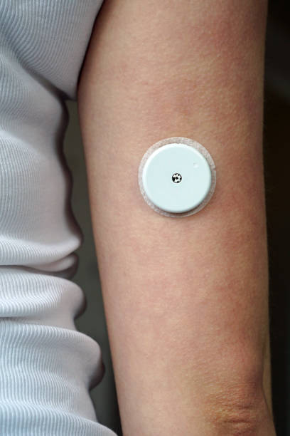 Leerling Discipline passagier Freestyle Libre Sensor On An Arm Stock Photo - Download Image Now - Diabetes,  Sensor, Insulin - iStock
