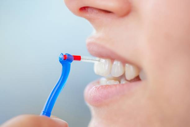 Extreme Close-up Of Young Woman Using Interdental Brush to Clean Between her Teeth - stock photo stock photo
