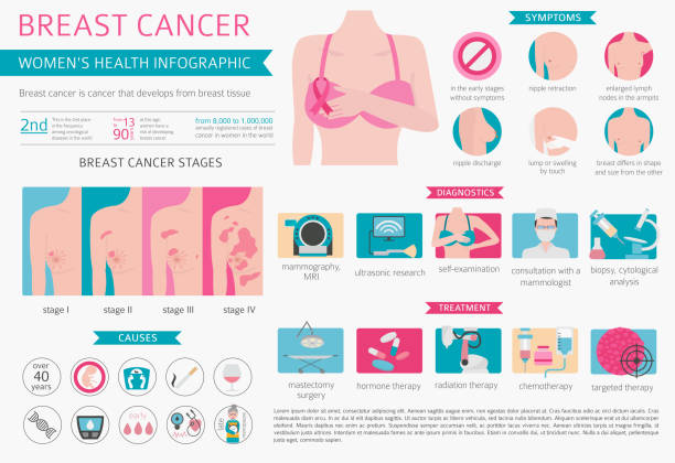 рак молочно й железы, медицинская инфографика. диагностика, симптомы, лечение. набор здоровья женщин - рак груди stock illustrations