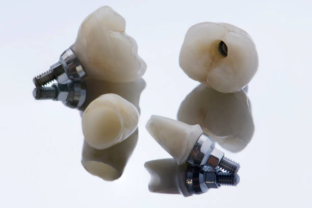 Dental technician working on a jaw model
