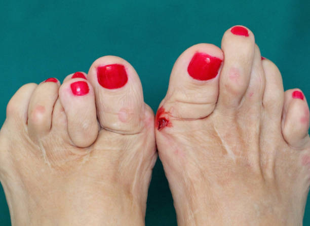 istock Mutilated feet, the greedy doctor did it 1226235926