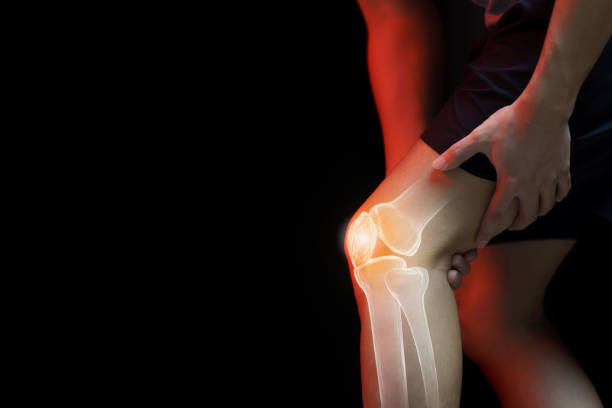 istock Medical concept, man suffering  with knee painful - skeleton x-ray, 1226250121