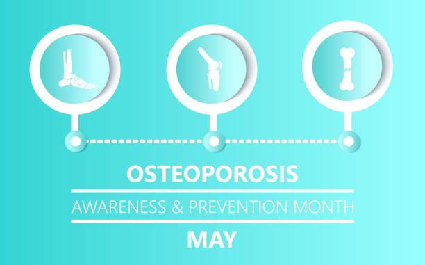 Osteoporosis awareness and prevention month is celebrated in May in USA. Knee, broken bone, foot icons are shown. Osteoporosis concept, osteoarthritis vector. Osteoporosis awareness and prevention month is celebrated in May in USA. Knee, broken bone, foot icons are shown. Osteoporosis concept, osteoarthritis anatomical vector. osteoporosis awareness stock illustrations
