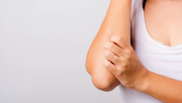 istock Asian beautiful woman itching her useing hand scratch itch Arm 1226301291