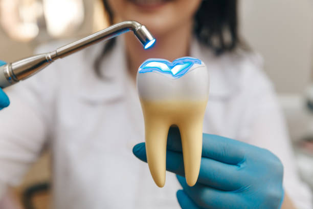 istock Process of filling on fake tooth. 1226358180