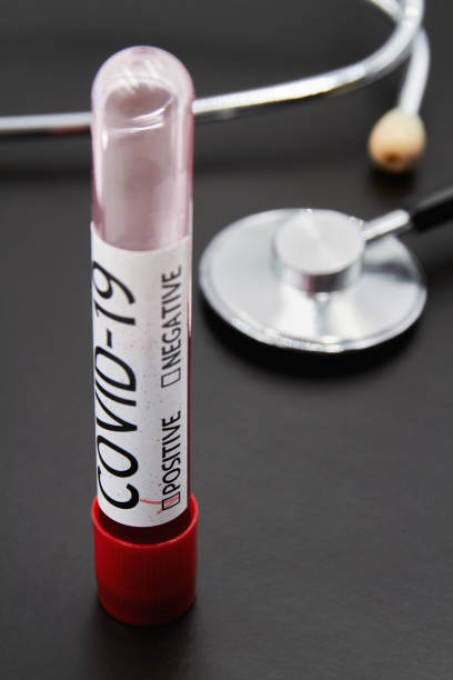 conceptual photo. blood test sample for presence of coronavirus and stethoscope on dark background. tube containing a blood sample that have tested positive for coronavirus. closeup - blood sample imagens e fotografias de stock