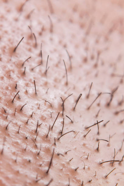 istock close-up image of thinned thin hair 1226440663