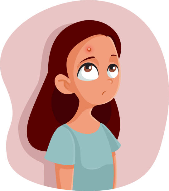 Sad Teenage Girl Having A Pimple Vector Cartoon Stock Illustration -  Download Image Now - Acne, Pimple, Hormone - iStock