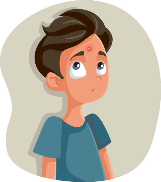 Sad Teenage Boy Having A Pimple Vector Cartoon Stock Illustration -  Download Image Now - Acne, Boys, Child - iStock