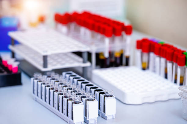 blood samples for research in microtubes. - multi well trays imagens e fotografias de stock