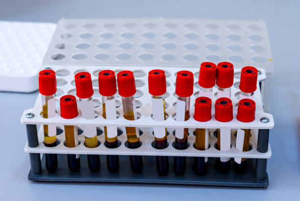 rack of blood tubes test for analysis in the laboratory of hematology. - multi well trays imagens e fotografias de stock