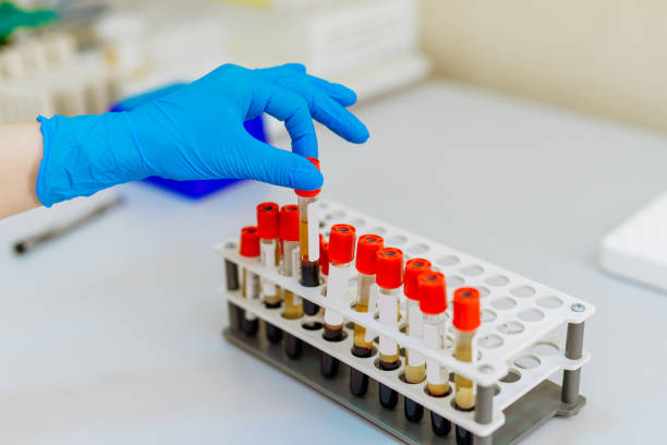 nurse a hand arranges test tubes with blood on a tray. - multi well trays imagens e fotografias de stock