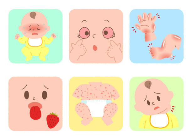 illustrazioni stock, clip art, cartoni animati e icone di tendenza di elenco dei sintomi della malattia di kawasaki - sindrome di kawasaki immagine