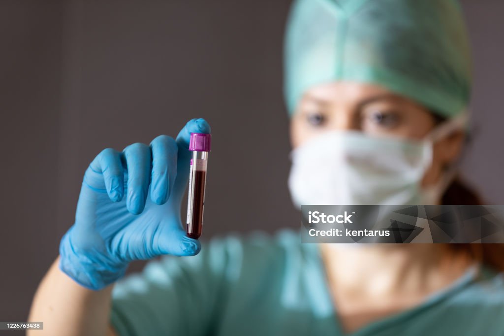 Antibody blood plasma therapy trials against corona virus pandemic Coronaviruses are a group of viruses that cause diseases in mammals and birds. Blood Group Stock Photo