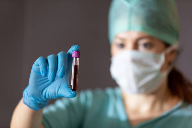 antibody blood plasma therapy trials against corona virus pandemic - infuse imagens e fotografias de stock