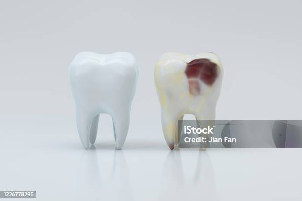 白い歯3dレンダリングと横に虫歯 - 歯のストックフォトや画像を多数ご用意 - 歯, 苦痛, 3D