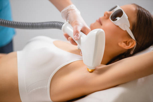hair removal from underarms side view on young caucasian female getting hair removal from underarms in salon. lady in protective eyeglasses and white underwear lie on bed while doctor use ipl machine device hairless animal photos stock pictures, royalty-free photos & images