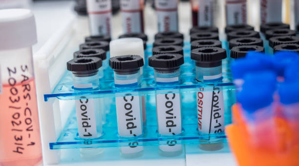 istock Vials with samples of SARS-COV-1 prepared cold in a laboratory, epiedomological study on Sars-CoV-2 Covid-19, conceptual image 1226935998