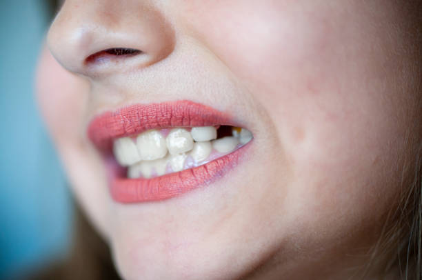 istock Girl has caries on teeth 1226978960