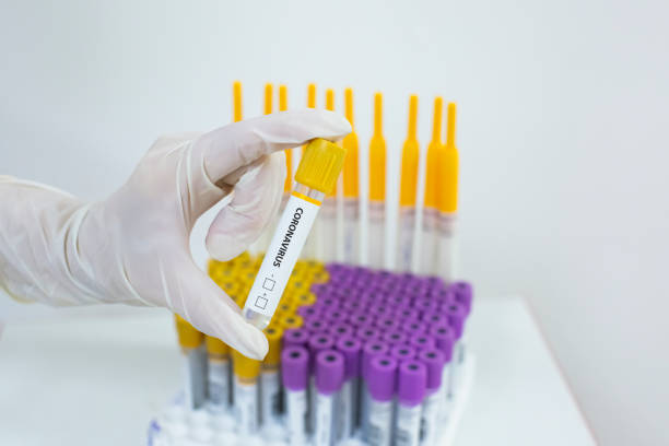 istock Coronavirus COVID-19 blood test tube 1227007747