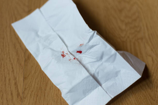istock Bloody tissue paper 1227011381