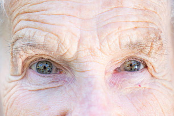 istock Beautiful, Sharp, Intelligent Elderly Senior Caucasian Woman's Unique Speckled Pretty Eyes and Face in the Summer Outdoors 1227036113