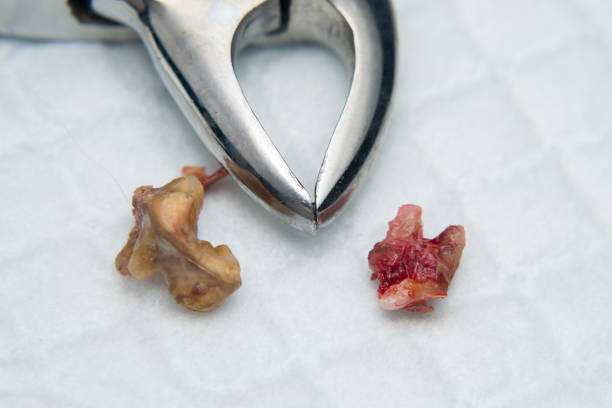 istock extracted dog teeth and extraction pliers close-up 1227155061