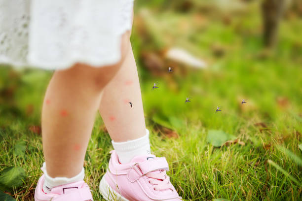 mignonne petite fille asiatique a l’éruption cutanée et l’allergie de la piqûre de moustique et sucer le sang aux jambes tout en jouant sur le champ d’herbe verte en plein air - malaria parasite photos et images de collection