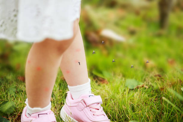 cute asian little girl has skin rash and allergy from mosquito bite and sucking blood at legs while playing on green grass field outdoor cute asian little girl has skin rash and allergy from mosquito bite and sucking blood at legs while playing on green grass field outdoor mosquito photos stock pictures, royalty-free photos & images